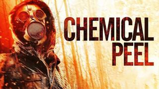 Chemical Peel