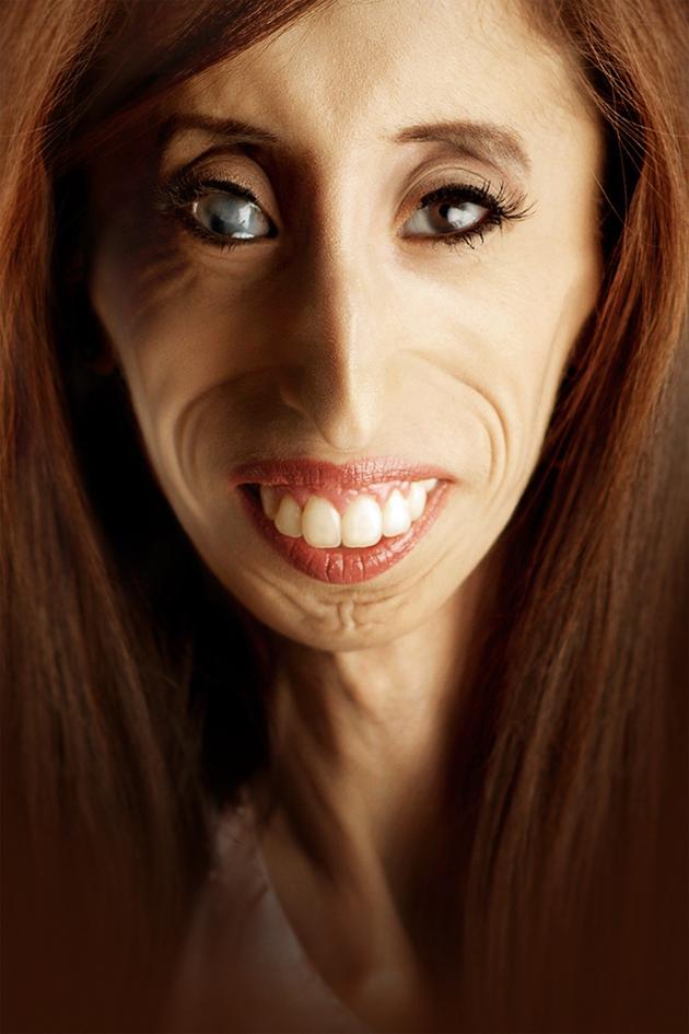 A Brave Heart: The Lizzie Velasquez Story