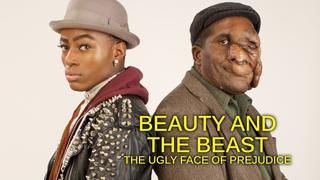 Beauty and the Beast: The Ugly Face of Prejudice