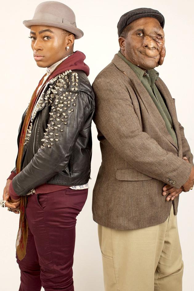 Beauty and the Beast: The Ugly Face of Prejudice