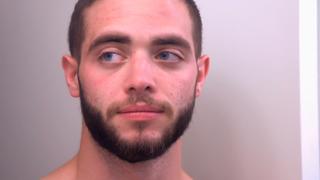 This Cyst Persists This Cyst Persists