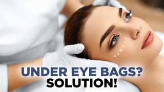  watch Under Eye Bags? SOLUTION!