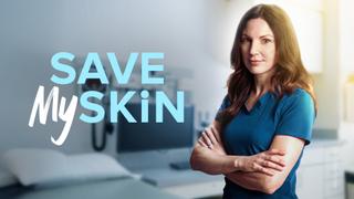 Save My Skin