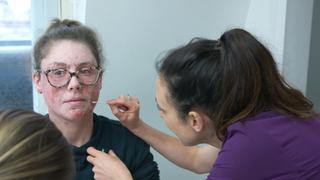 Eczema-stential Crisis
