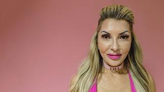 Botox Party Crasher Botox Party Crasher
