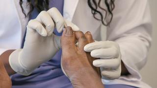 Hammertoes Happen