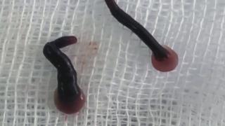 Mystery of the Face Parasite Mystery of the Face Parasite
