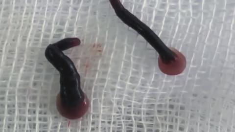 Mystery of the Face Parasite