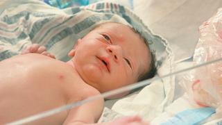 Epidurals