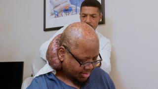 The Man With the Spicy Tumor The Man With the Spicy Tumor