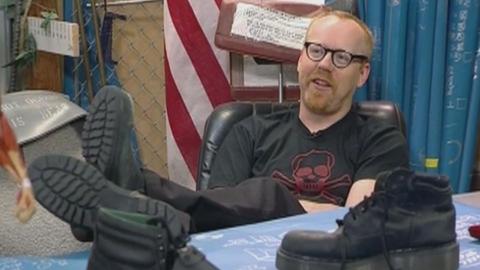 Steel Toe Amputation