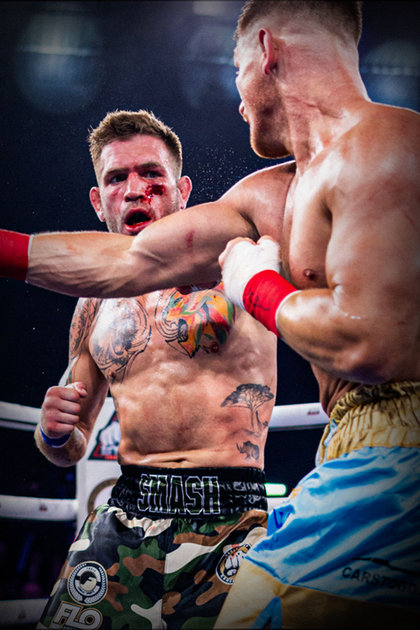 BKB: Bare Knuckle Boxing