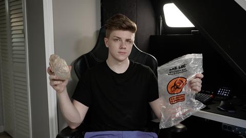 Missing Half A Skull