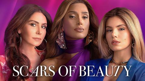 Scars of Beauty
