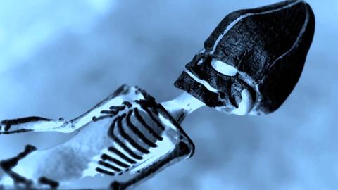 The Atacama "Alien" Skeleton