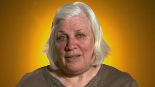 The Woman With the Giant Lump The Woman With the Giant Lump