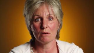 The Boy Who Bit Himself The Boy Who Bit Himself