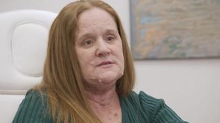 Tumors, Tumors, Everywhere Tumors, Tumors, Everywhere