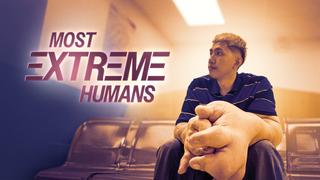 Most Extreme Humans