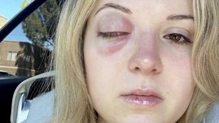 ER: Caught on Camera