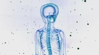 Trapped Inside Their Bodies Trapped Inside Their Bodies