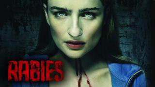 Rabies