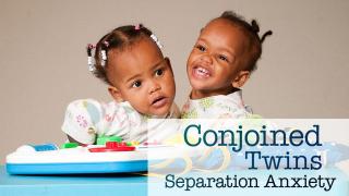 Conjoined Twins: Separation Anxiety