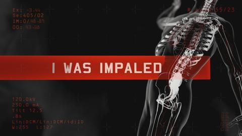 I Was Impaled